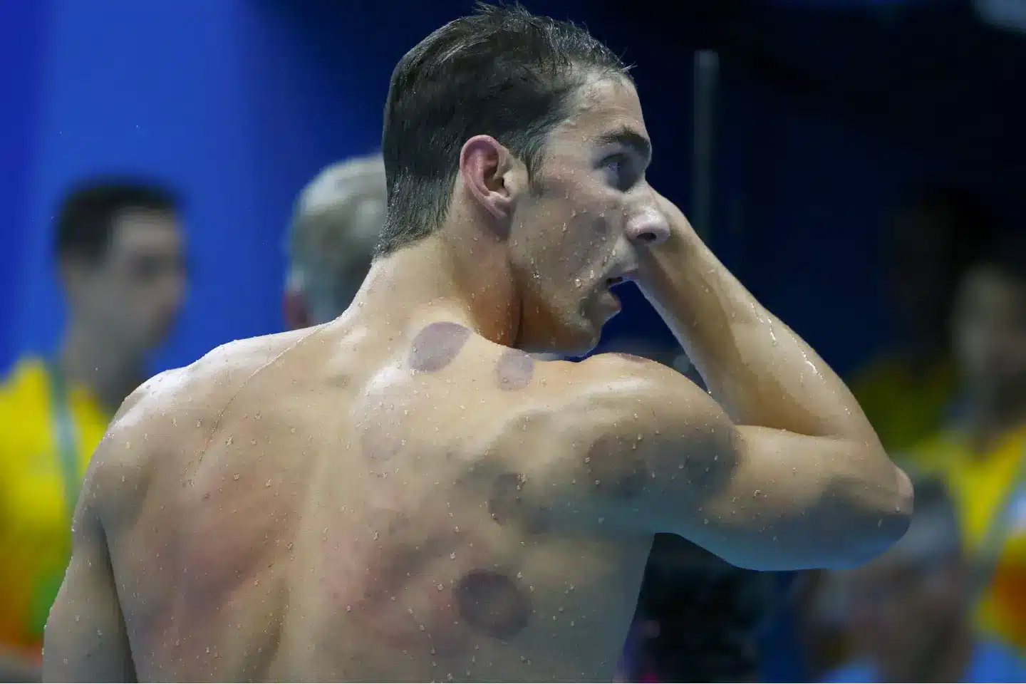 Ventouses utilisées par des athlètes